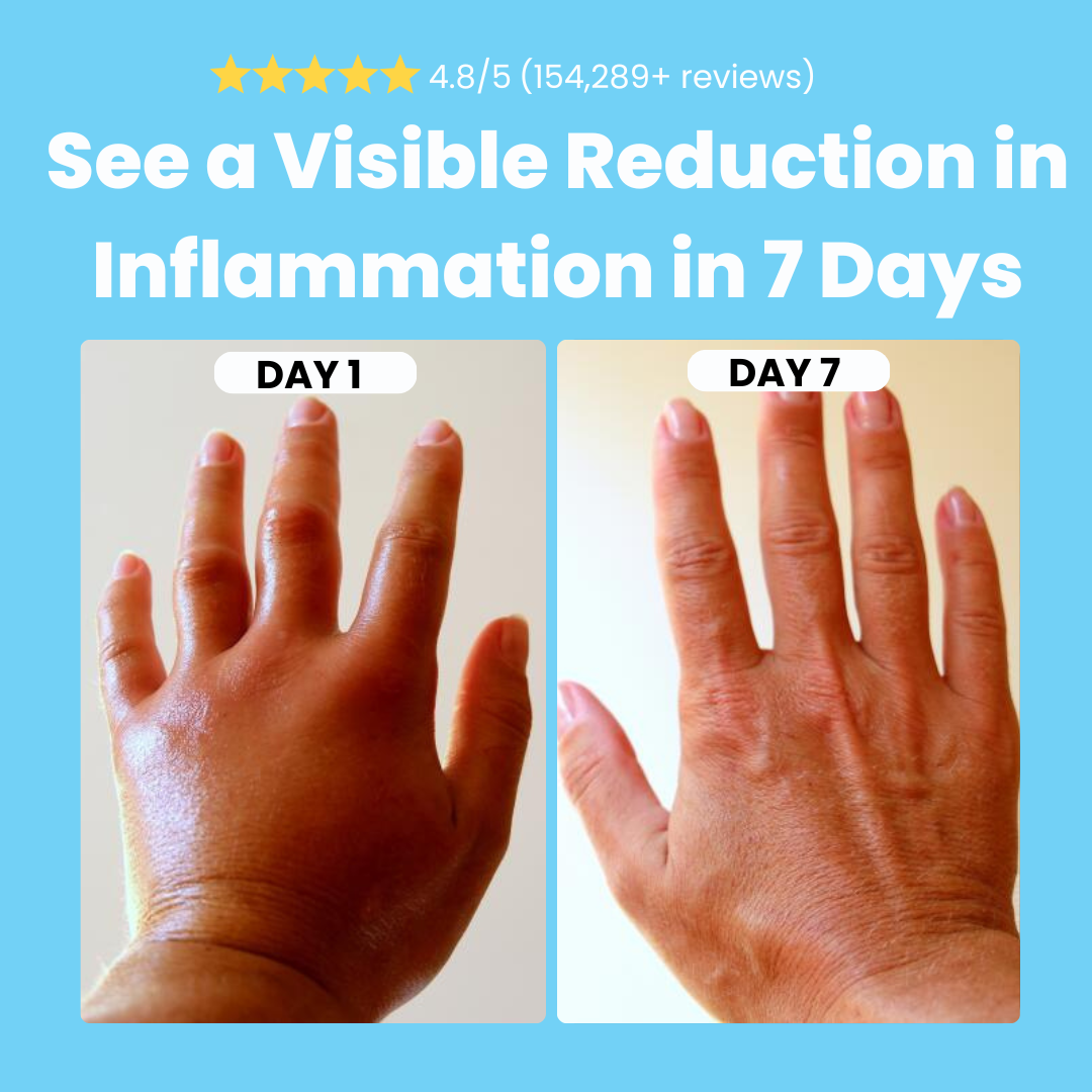 Velinco™ - Massager for Hand Pain