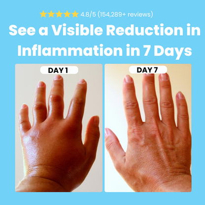 Velinco™ - Massager for Hand Pain